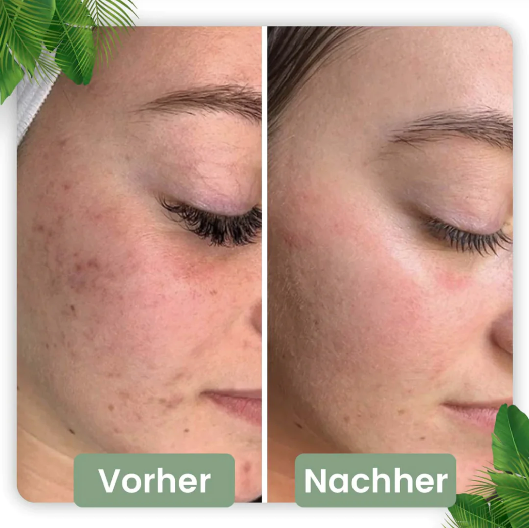 Stick Nettoyant Profond pour une Peau Rayonnante | Infusion de Thé Vert Naturel