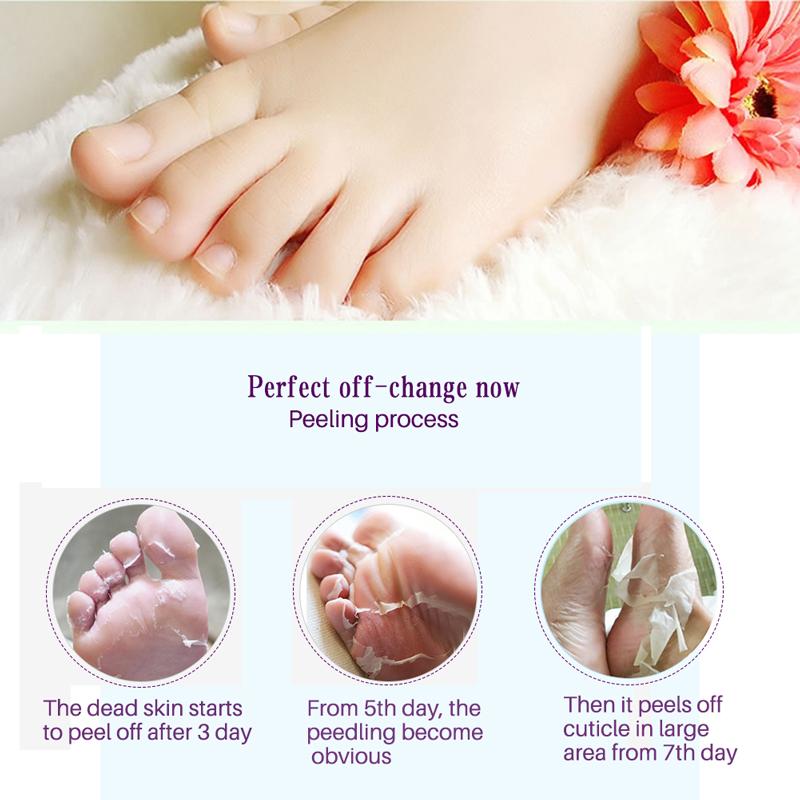 Lavender Foot Peel Treatment for Smooth Soft Feet – Removes Rough Dry Cracked Heels Dead Skin & Calluses Natural Exfoliating Booties