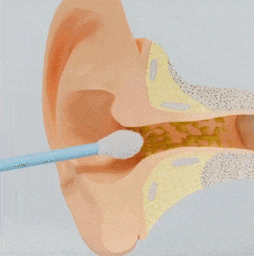 Visual Ear Wax Removal Tool with HD Camera Scope for iPhone Android Wireless Ear Cleaning Kit Safe Scoop Adults Kids