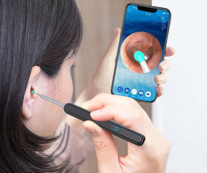 Wireless Ear Cleaning Camera with HD Scope and Silicone Tip for iPhone & Android Safe Wax Removal Tool