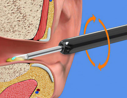 Visual Ear Wax Removal Tool with HD Camera Scope for iPhone Android Wireless Ear Cleaning Kit Safe Scoop Adults Kids