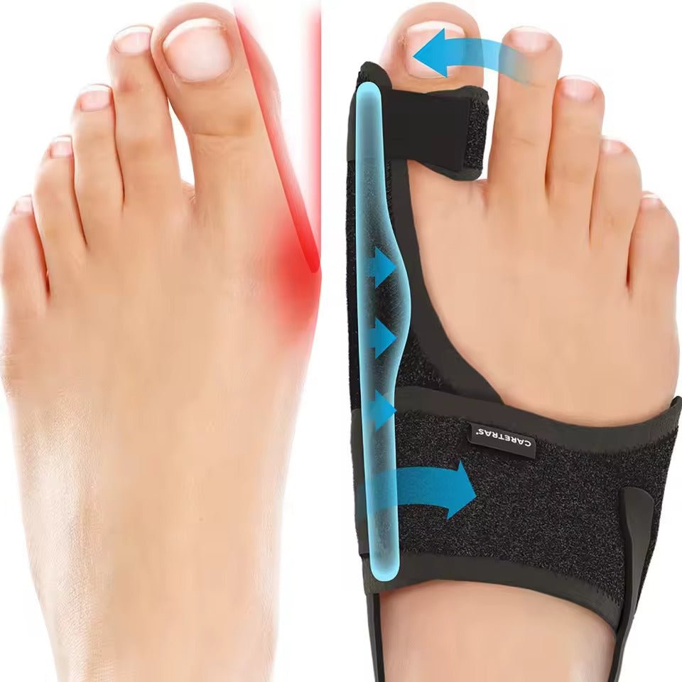 Adjustable Bunion Corrector Night Splint for Big Toe Alignment – Ergonomic Hallux Valgus Support Brace for Left or Right Foot, Comfortable